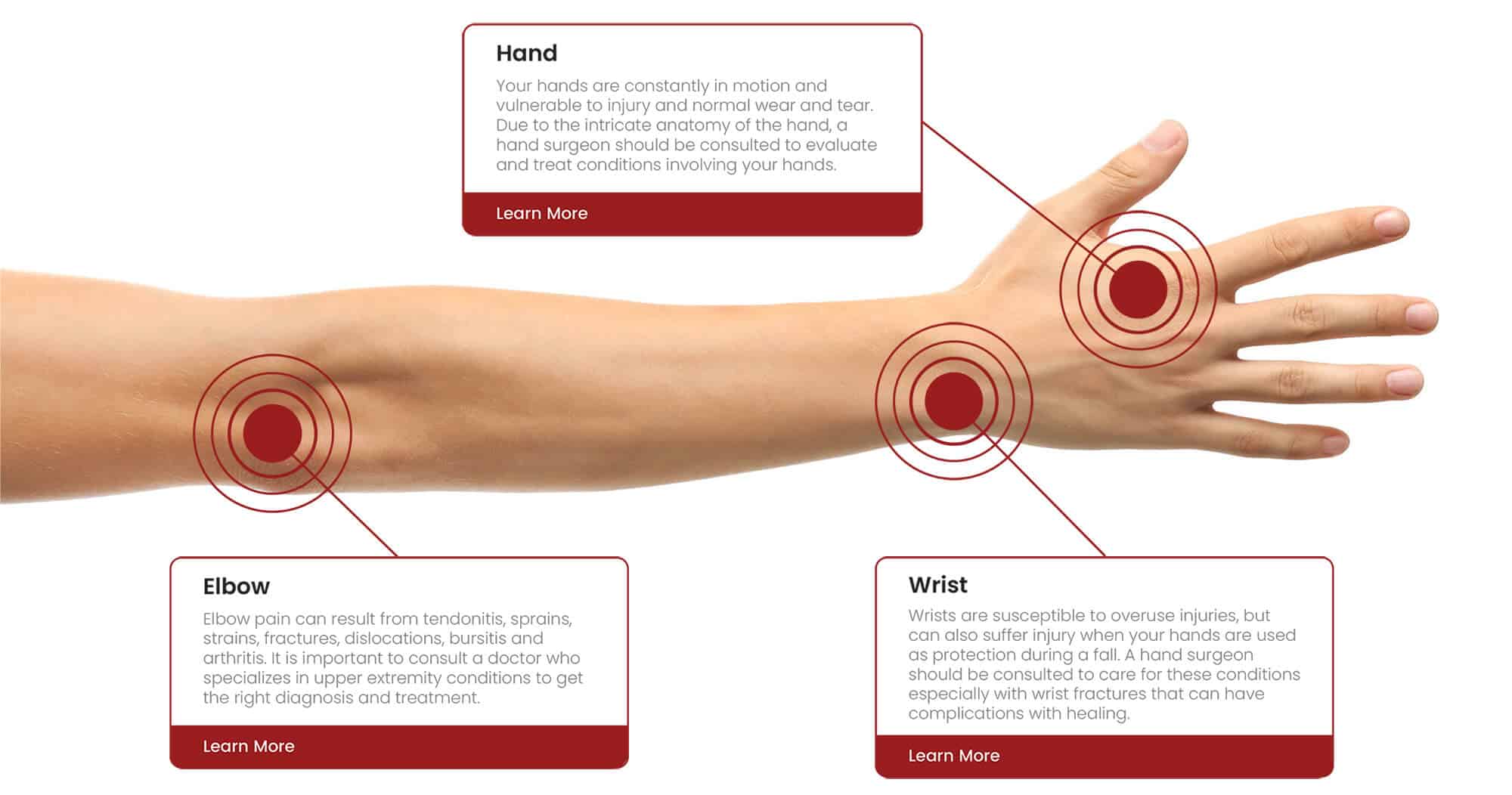 Infographic for the arm showing the hand, wrist, and elbow and how they may be affected by pain or injury