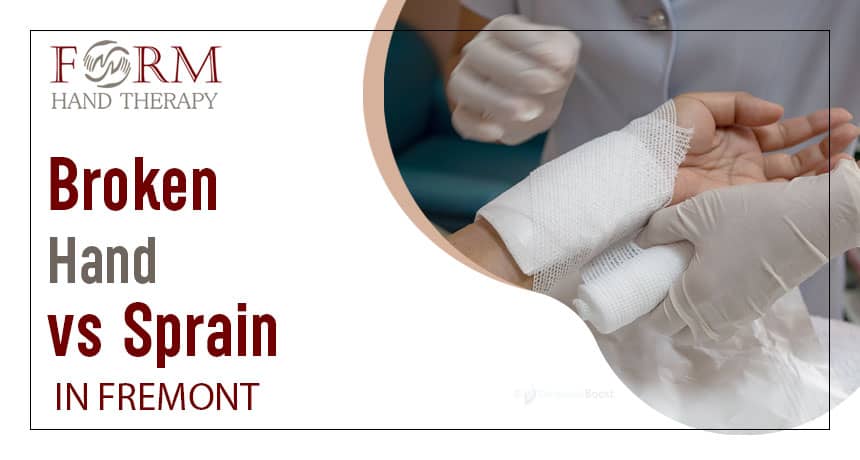 Broken Hand vs. Sprain