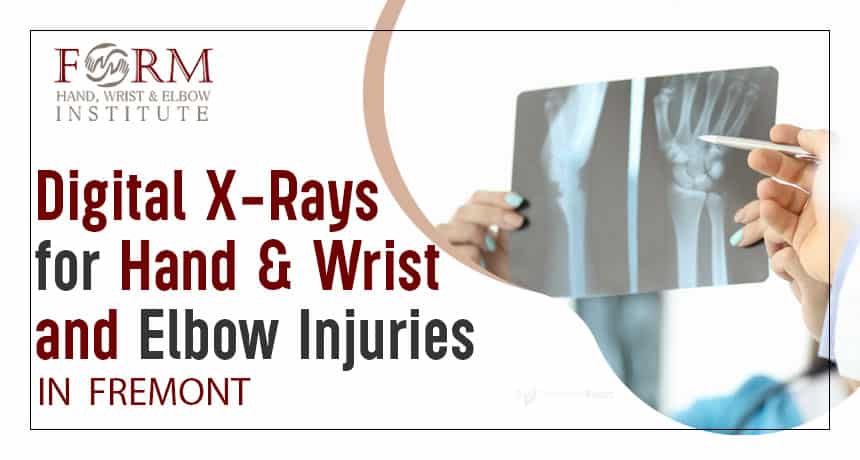Digital X-Rays for Hand, Wrist, and Elbow Injuries in Fremont