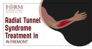 Radial Tunnel Syndrome Treatment