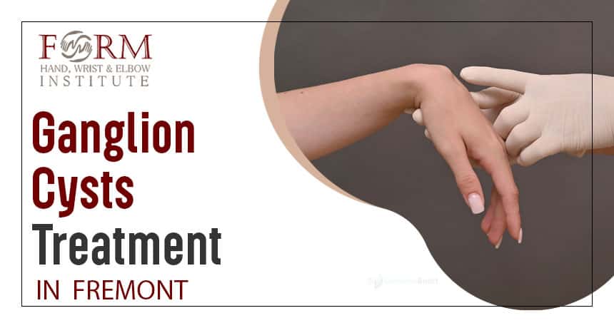 Ganglion Cysts Treatment in Fremont