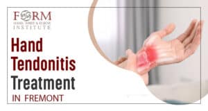 Hand Tendonitis Treatment in Fremont